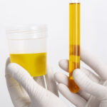 lab doctor performing medical exam urine